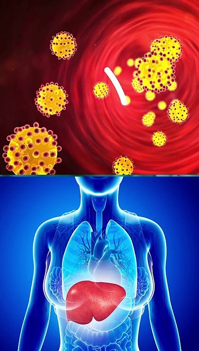 Raise Your HDL naturally (Improve Good Cholesterol) | DM HEART CARE CLINIC
