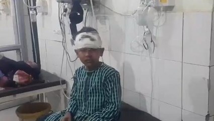 बदायूं:मामूली कहासुनी में शराबियों द्वारा किए गए पथराव में मासूम हुआ घायल