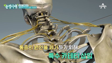 물려주고 싶지 않은 직업병! 목&어깨 근육강화 운동법 3가지