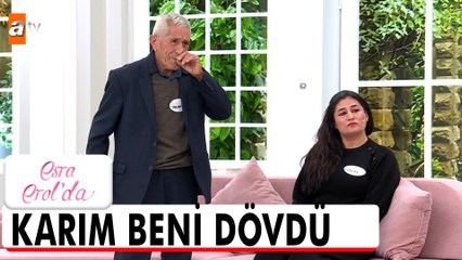 76 yaşındaki Mehmet Amca 28 yaş küçük eşinden dayak yedi! - Esra Erol'da 12 Aralık 2022