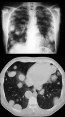 SIGNO DE LA SUELTA DE GLOBOS