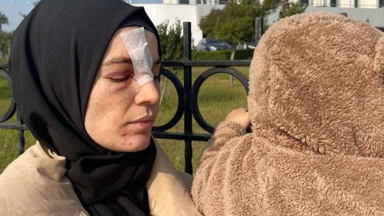 Cinsel ilişki teklifini reddeden kadın, kocası tarafından öldüresiye dövüldü