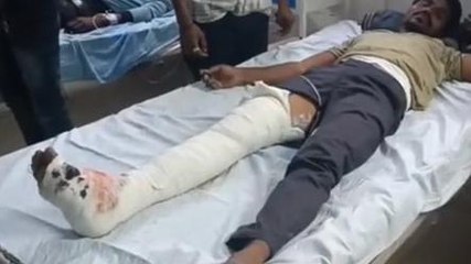 खरगोन :दो बाइकों की आमने-सामने भिड़ंत, घायल की हालत गंभीर,देखें वीडियो