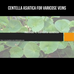 Centella asiatica for varicose veins