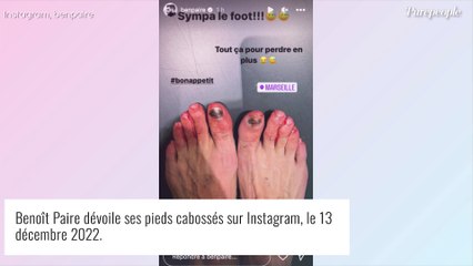 Tải video: Benoît Paire dévoile une photo ignoble d'une partie de son corps, âmes sensibles s'abstenir...