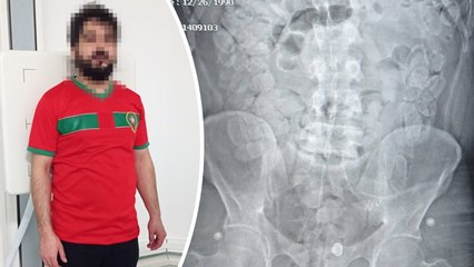 Yalova’da yakalanan Faslı turistin midesinde 1,5 kilo reçine esrar çıktı