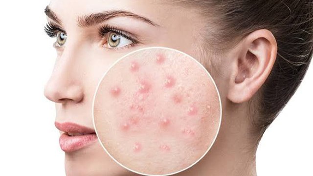 चेहरे को साफ़ रखने के लिए करें ये काम । चेहरे को साफ़ रखने के फायदे । Boldsky *Health