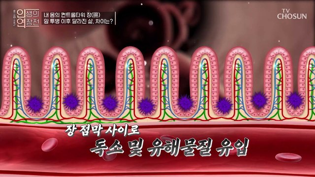 사망 1위 암을 유발하는 장내 미생물의 불균형 TV CHOSUN 20221214 방송