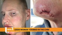 Leeds headlines 14 December: Leeds woman ‘stabbed in the chin’