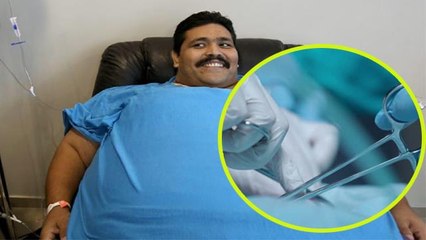 444 किलो के Andres Moreno के साथ क्या हुआ था | Weight Loss Surgery के नुकसान | Boldsky *Health