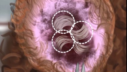 Give a stray dogs a bath and erase the pressure #asmrsounds