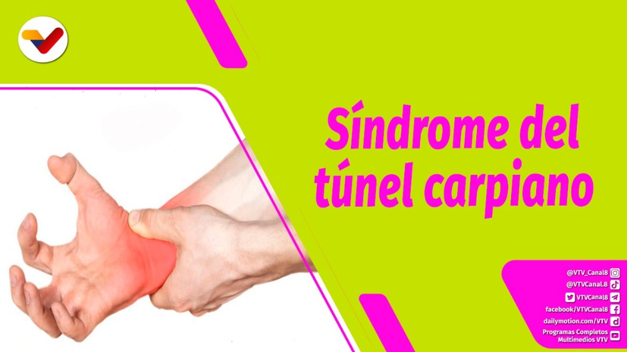 Buena Vibra | ¿Por qué se produce el síndrome de túnel carpiano y cuál es su tratamiento?
