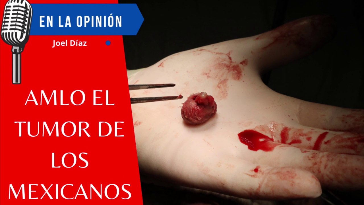 AMLO el Tumor de México