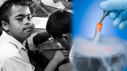 Stem Cell Therepy से Autism का इलाज कैसे, Stem Cell Therepy क्या है|Boldsky*Health