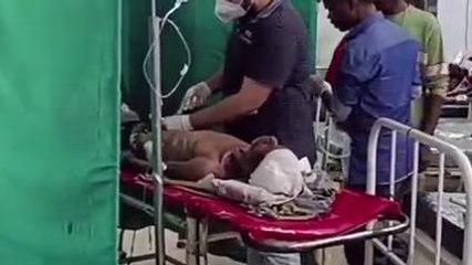 छिंदवाड़ा : वाहन चालक अनियंत्रित होकर गिरा, कई जगह गंभीर चोट