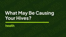 Primary Care Doctor Breaks Down What Causes Hives | Deep Dives | Health