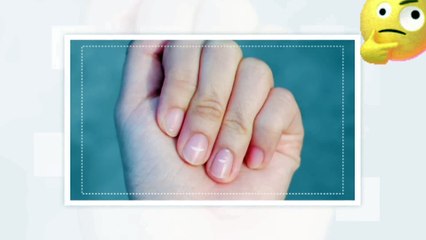 गोलगप्पे देश में बैन  l Golgappas are banned in the country #viralshorts