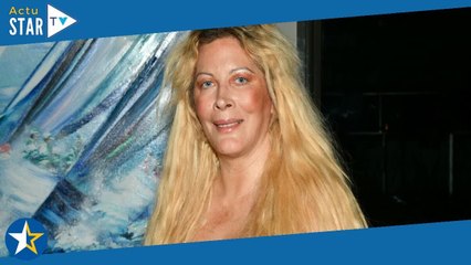 "J'ai eu très peur" : Loana, hospitalisée, montre une effrayante photo de sa grosse blessure au doig