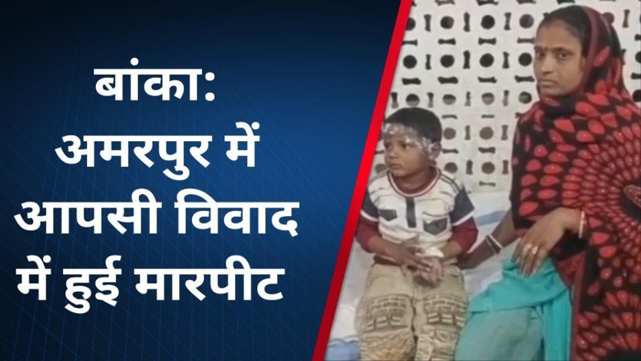 बांका: आपसी विवाद में हुई मारपीट में पति पत्नी जख्मी, बच्चा झुलसा