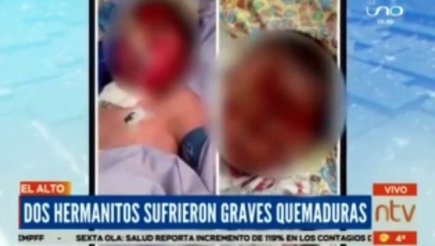 Piden ayuda para los dos hermanitos que sufrieron quemaduras por prepararse el té