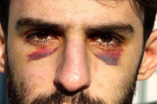 Yunan zulmü ile nehrin ortasında 16 gün mahsur kalan göçmenler Türk askeri tarafından kurtarıldı