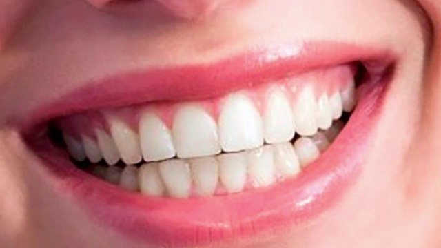 bd-dudas-frecuentes-sobre-problemas-de-encias-191222