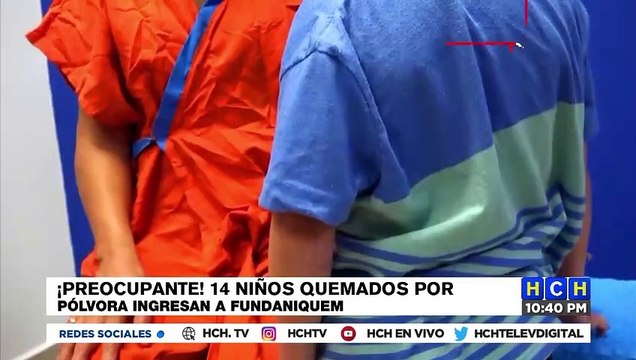 Al menos 14 menores han resultado con quemaduras por uso de pólvora en Honduras
