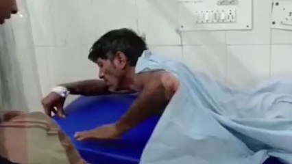 मुरादाबाद:शादी समारोह में खौलते तेल की कढ़ाई में गिरकर हलवाई हुआ घायल