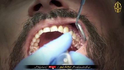 How to whiten your teeth naturally at home in 1 minute - Toothache is gone forever - IT