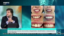 Consultório 15 dezembro, parte 1 - Facetas dentárias resultam num sorriso mais simétrico e bonito