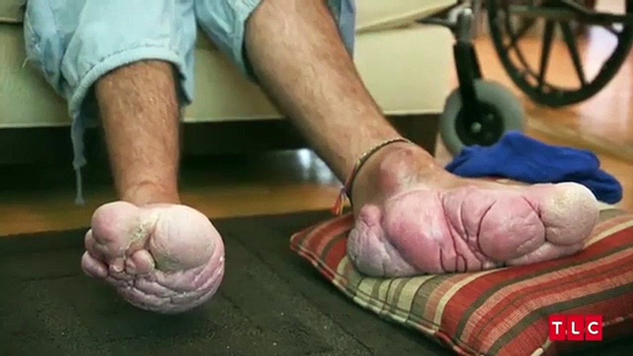 My Feet are Killing Me - Se1 - Ep02 HD Watch HD Deutsch