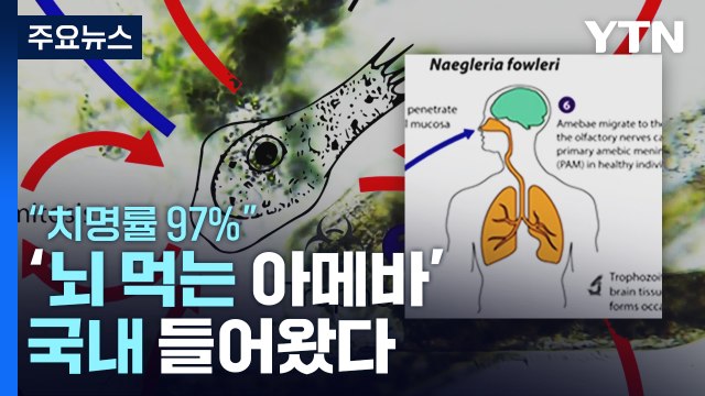 국내 첫 '뇌 먹는 아메바' 감염으로 50대 사망... 치명률 97% / YTN