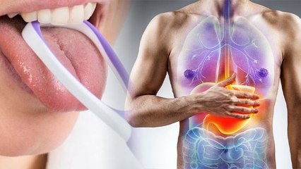 Daily Tongue Clean करने से क्या होता है | Tongue Clean करने के फायदे | Boldsky *health