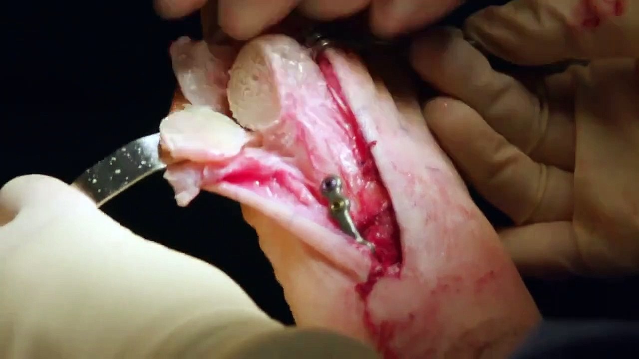 My Feet are Killing Me - Se3 - Ep05 Mass of Mystery HD Watch HD Deutsch