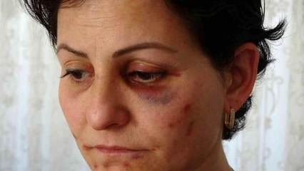 Arabayla takip ettikleri anne ve kızı döverek hastanelik ettiler...O anlar kamerada