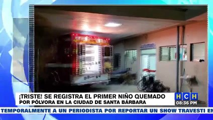 Se registra el primer menor quemado por pólvora en Santa Bárbara