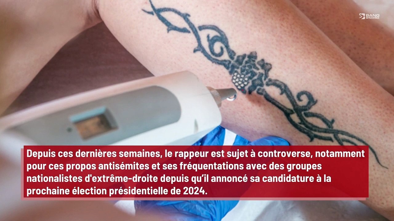 Londres : un studio retire gratuitement les tatouages de Kanye West !