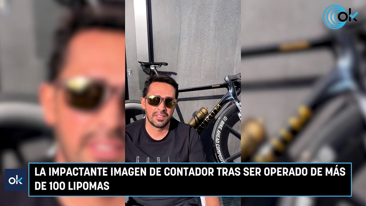 La impactante imagen de Contador tras ser operado de más de 100 lipomas