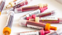 So ermittelt ihr eure Blutgruppe - und warum das wichtig ist