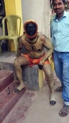 इस इन्सान की सकल क्यों देखना पसन्द नहीं करते हैं लोग