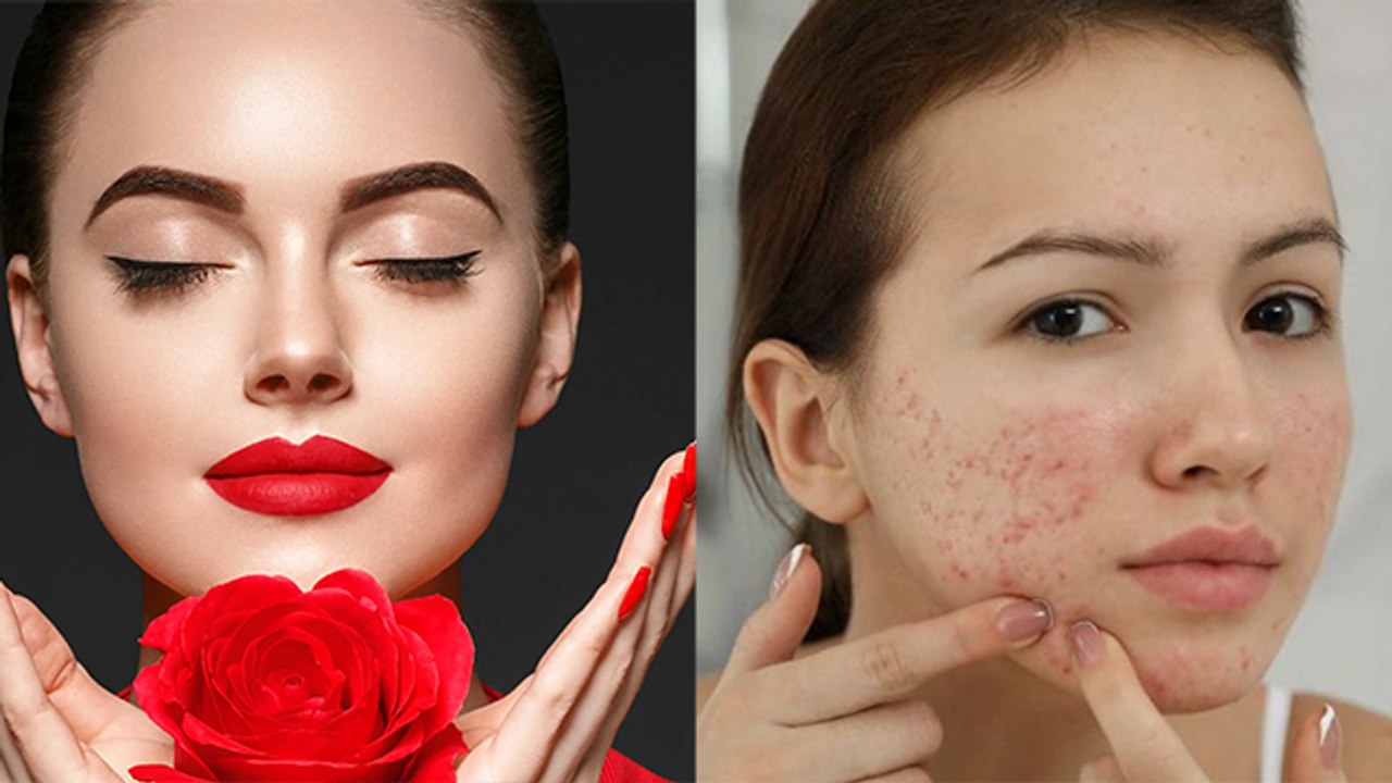 चेहरे पर गुलाब की पंखुड़ियां लगाने से क्या होता है | चेहरे पर गुलाब की पंखुड़ियां लगाने के फायदे