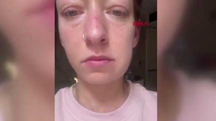 Danimarkalı kız kardeşler İstanbul'da Suriyelilere ait kaçak merkezde ameliyat oldu! Sonrası kabus