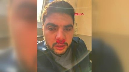 SANCAKTEPE'DE HASTA YAKININDAN HEMŞİREYE YUMRUKLU SALDIRI