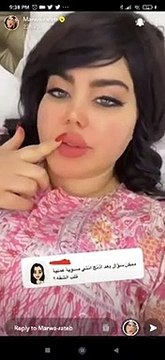 مروة راتب تكشف حقيقة خضوعها لتجميل الشفاه