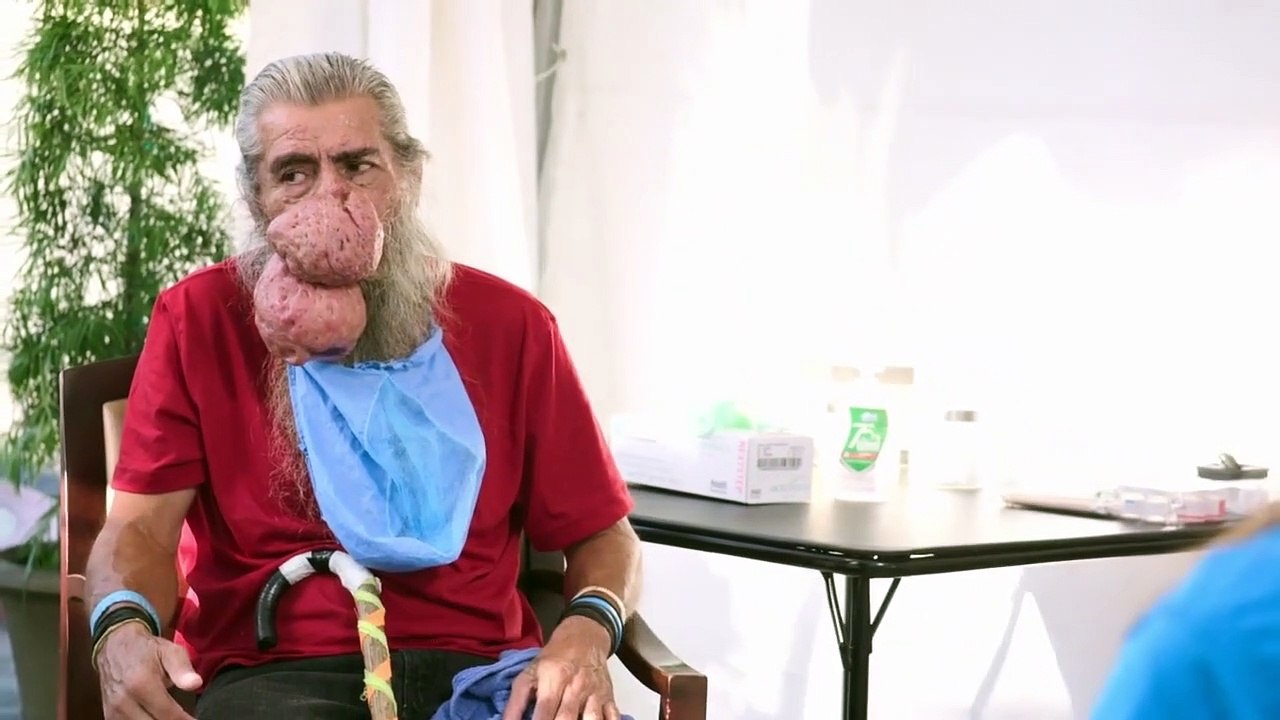 Dr. Pimple Popper - Se6 - Ep01 HD Watch