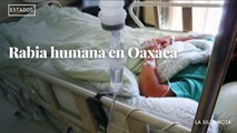 Encienden las alertas por rabia humana en Oaxaca