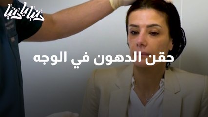 حقن الدهون في الوجه