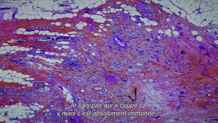 De humani corporis fabrica - Trailer