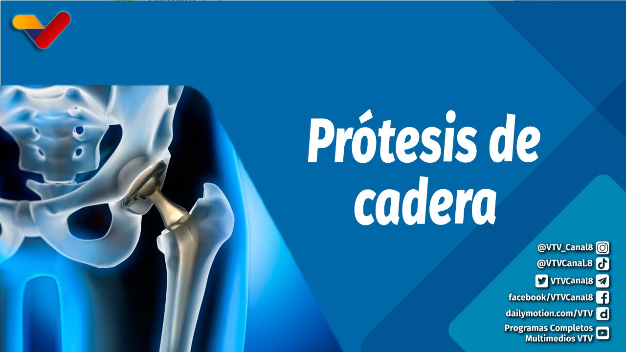 Actitud Saludable | ¿En qué consiste el reemplazo de cadera artificial?