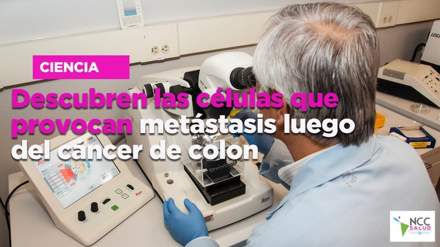 Descubren las células que provocan metástasis luego del cáncer de colon